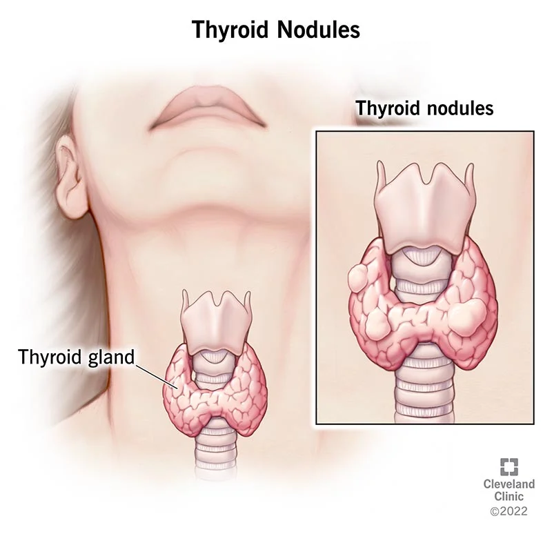 Thyroid
